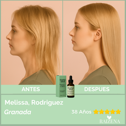 VivaHair Serum Fortalece y Revitaliza tu Cabello