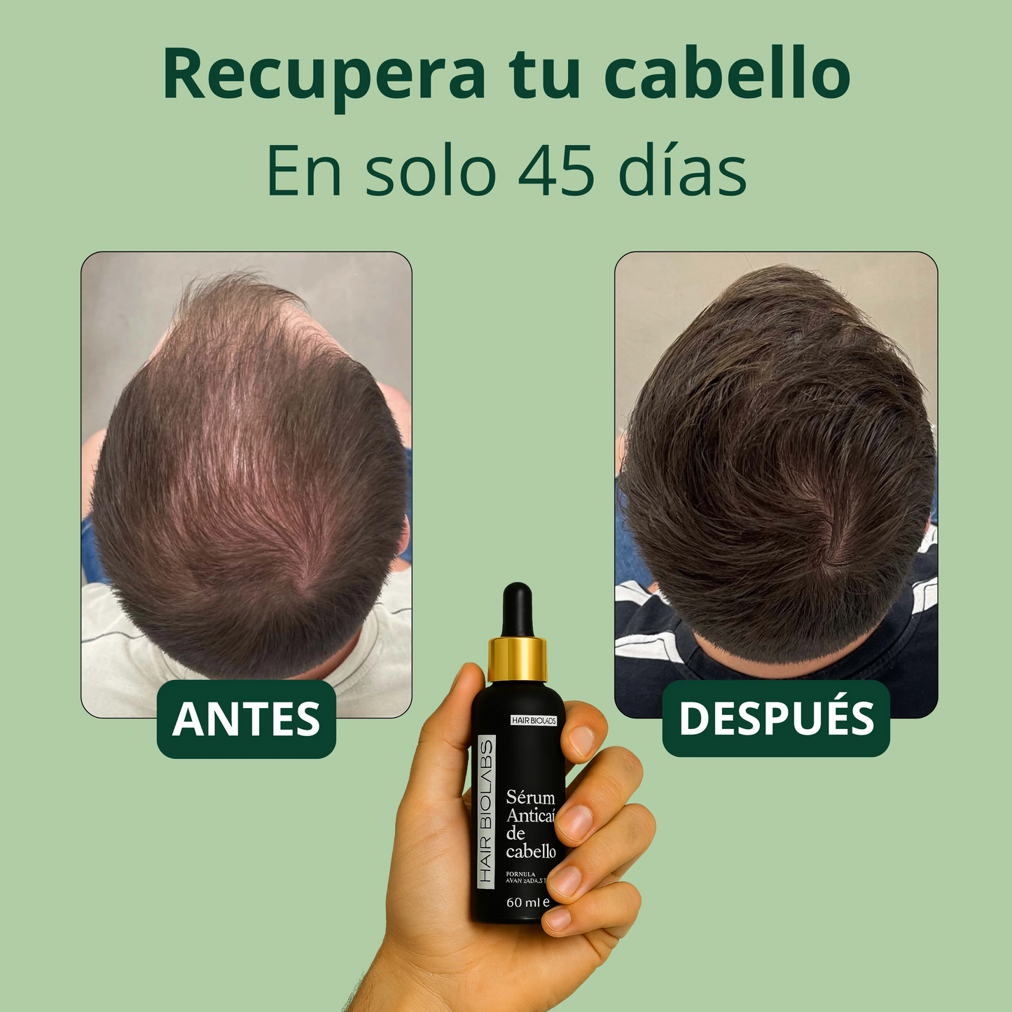 Hair Biolads Cabello Fuerte, Vida Nueva