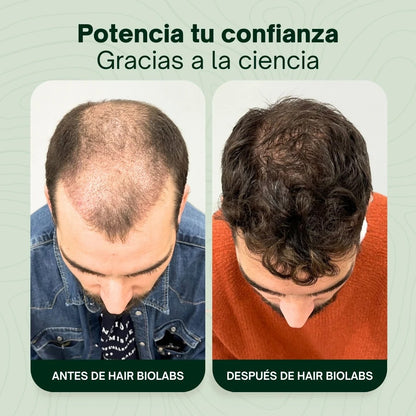 Hair Biolads Cabello Fuerte, Vida Nueva