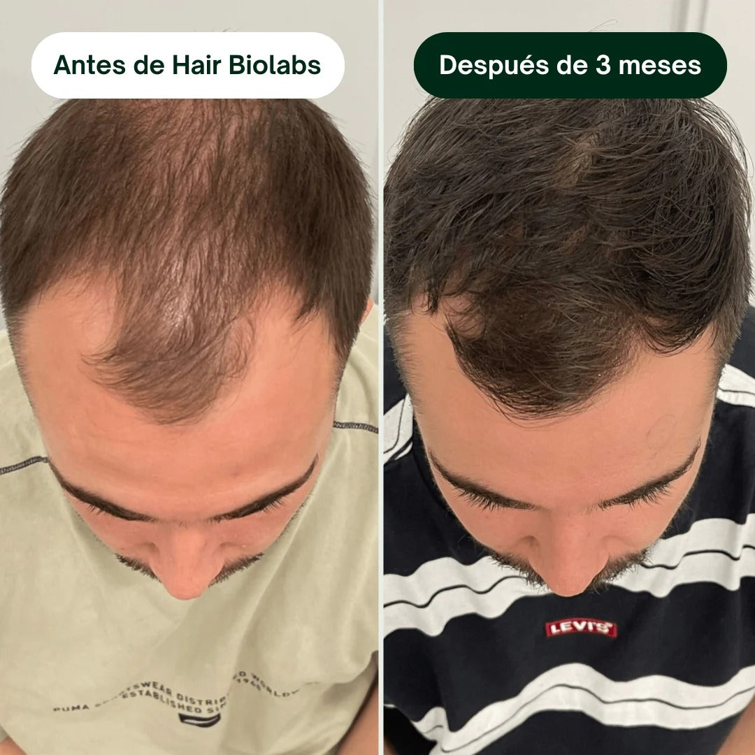 Hair Biolads Cabello Fuerte, Vida Nueva